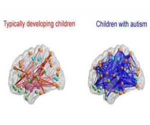 Social Symptoms In Autistic Children May Be Caused By Hyper-connected ...