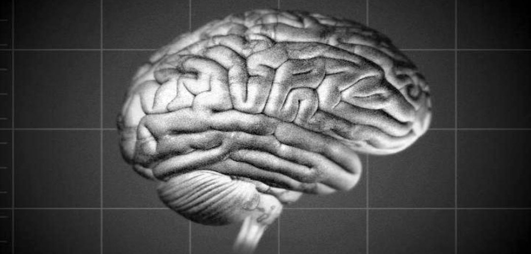 Imaging the brain at multiple size scales: New technique can reveal