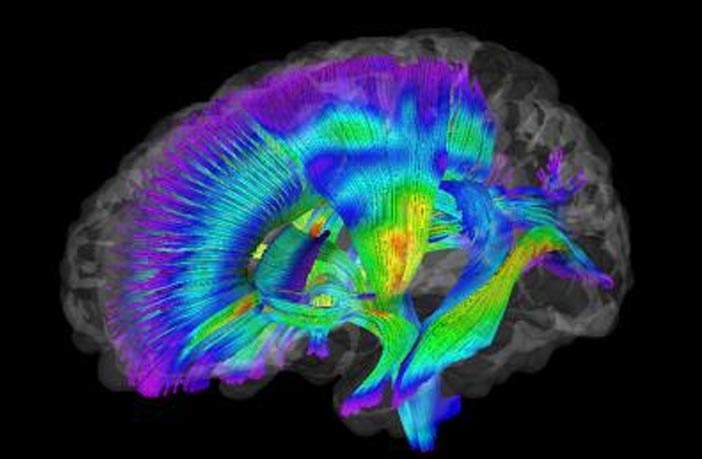 Diffusion Tensor Imaging in Traumatic Brain Injury