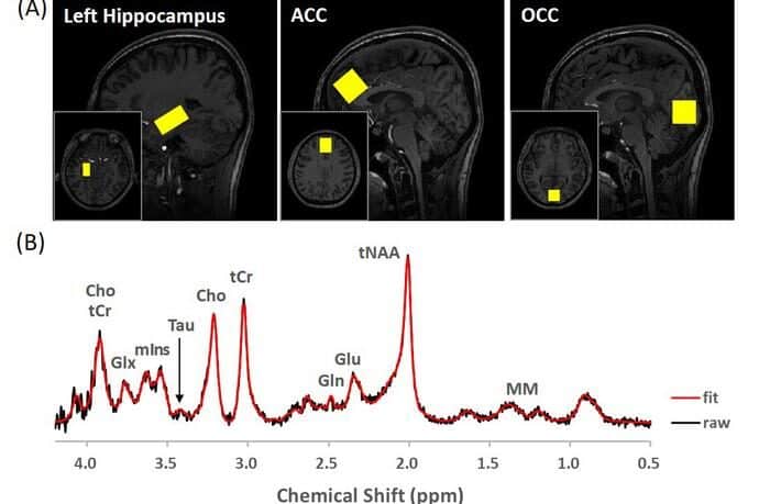 People with despair have decrease concentrations of taurine within the hippocampus