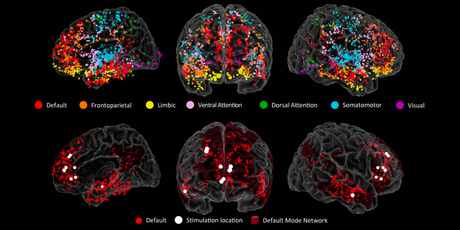 Neurolodzy identyfikują sieć mózgową ważną dla generowania kreatywnych pomysłów